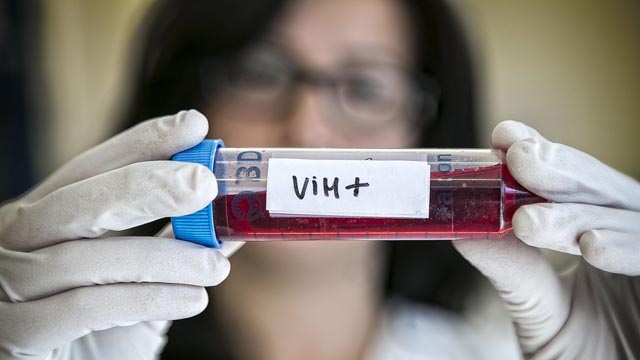 Logran remitir por segunda vez el VIH con células madre